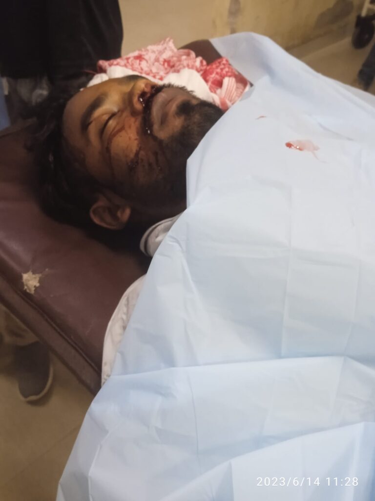 रांची यूनिवर्सिटी के सेंट्रल लाइब्रेरी भवन का हिस्सा टूटा | एक स्टूडेंट की मौत Jharkhand districts news | jharkhand latest news | jharkhand latest hindi news | jharkhand news box bharat