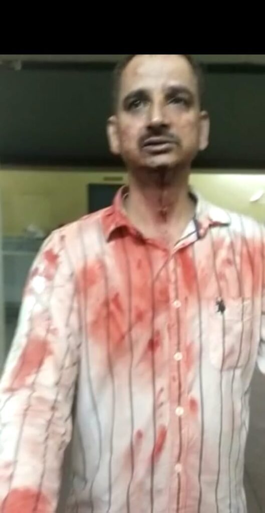 अरगोड़ा थाना के मुंशी पर लगा मारपीट का आरोप, पुलिस ने किया इंकार Jharkhand districts news | jharkhand latest news | jharkhand latest hindi news | jharkhand news box bharat